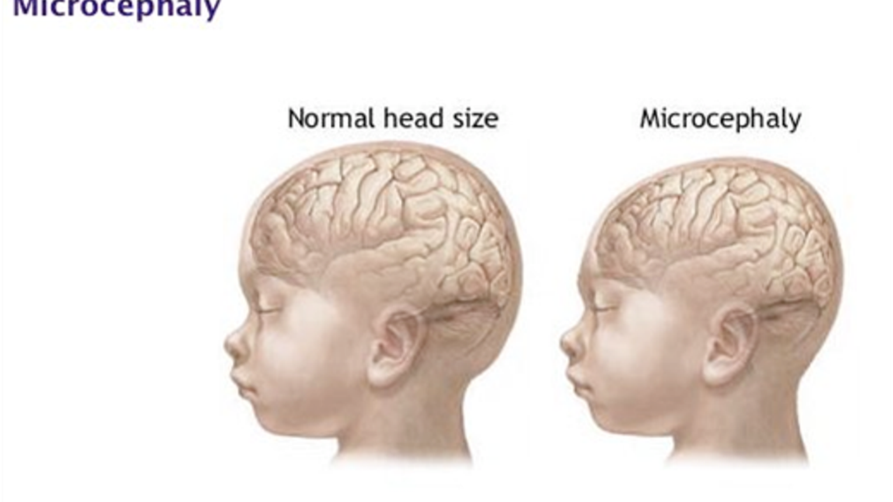 [Bintang] 4 Hal yang Harus Kamu Tahu tentang Virus Zika