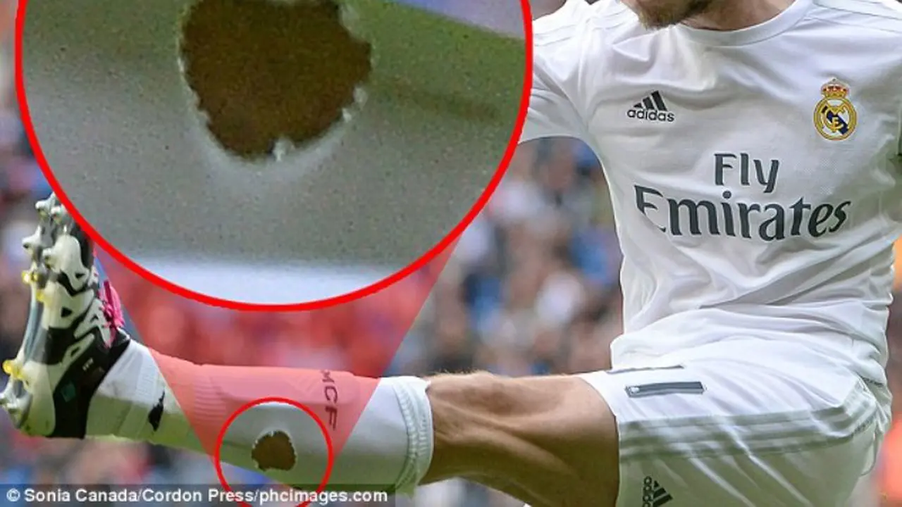 Gareth Bale