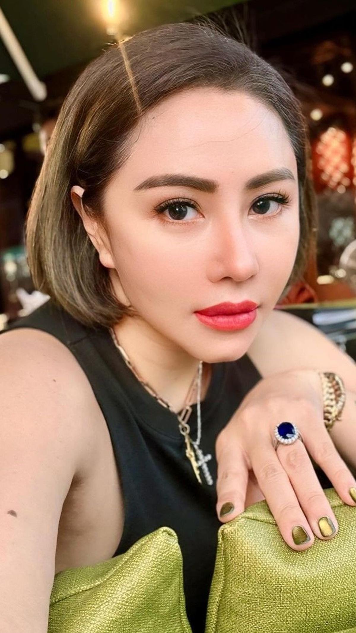 Pernah Koma Hingga Amnesia dan Tak Kenali Orang <br>