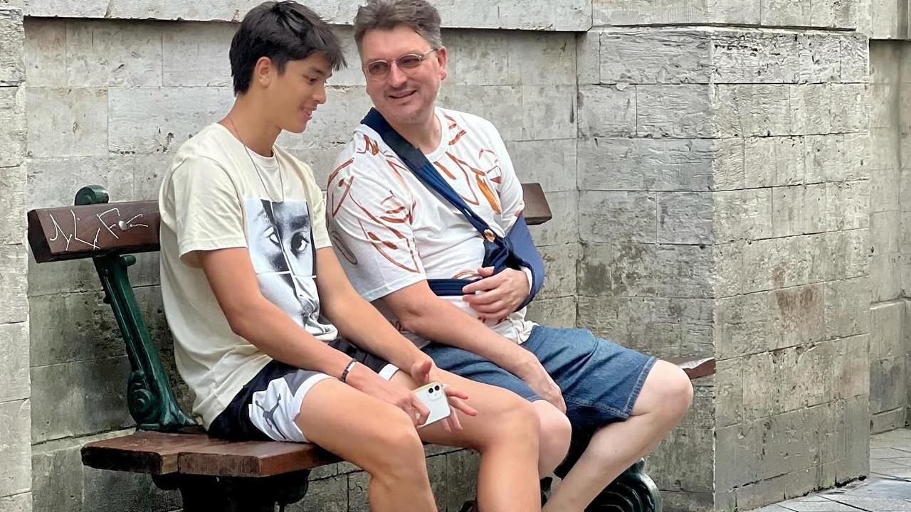 Potret Erick Meijer Suami Maudy Koesnaedi Mengalami Cedera di Tangan