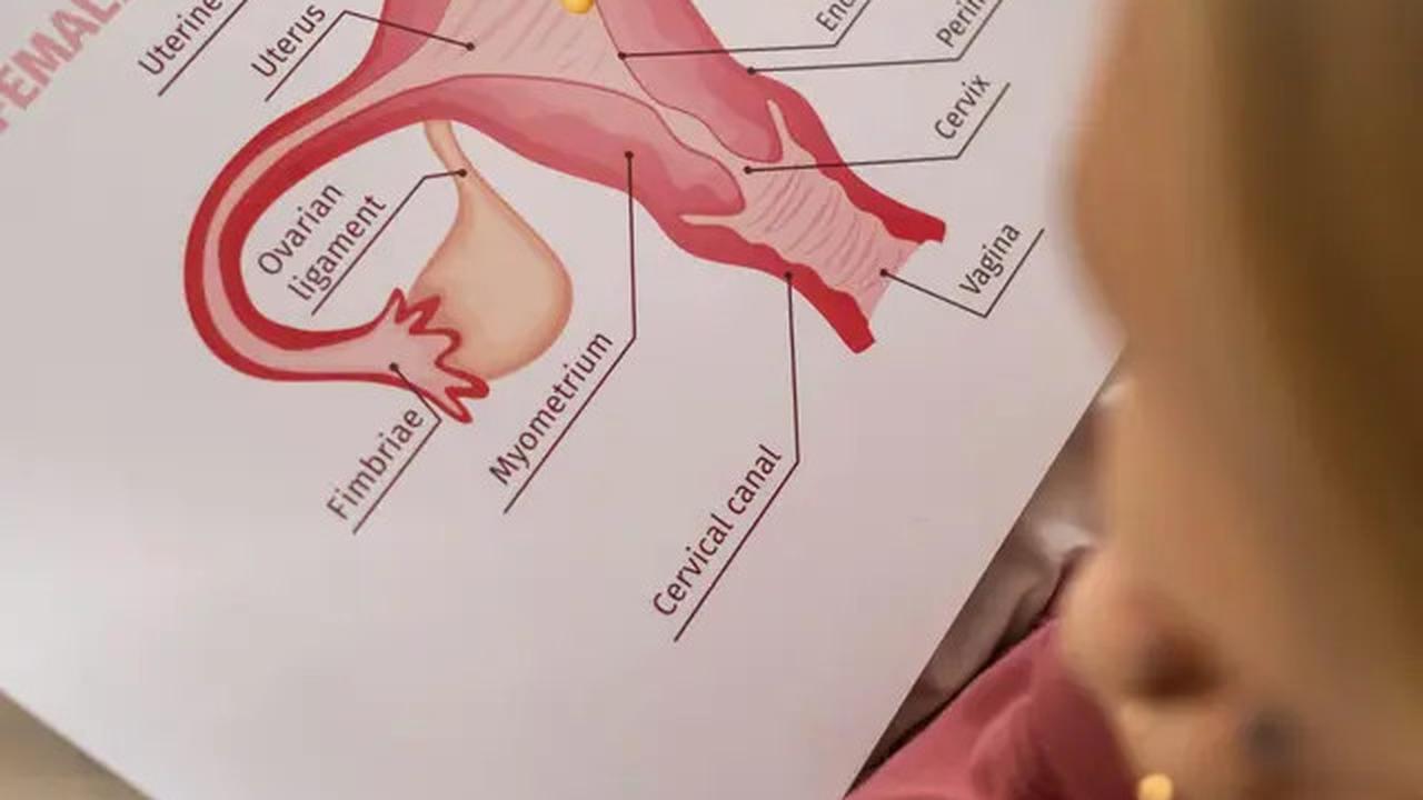 Miom Adalah Tumor Jinak di Dinding Rahim, Kenali Gejala dan Penyebabnya