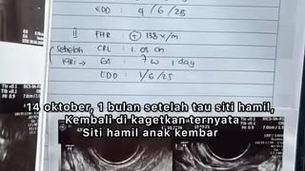 Mengandung Anak Kembar, Siti Badriah Lakukan Operasi Pengangkatan Satu Janinnya karena di Luar Rahim - Bakal Bahayakan sang Ibu