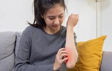 Kenapa Kulit Bisa Gatal? Ini 4 Pemicu yang Wajib Kamu Tahu!