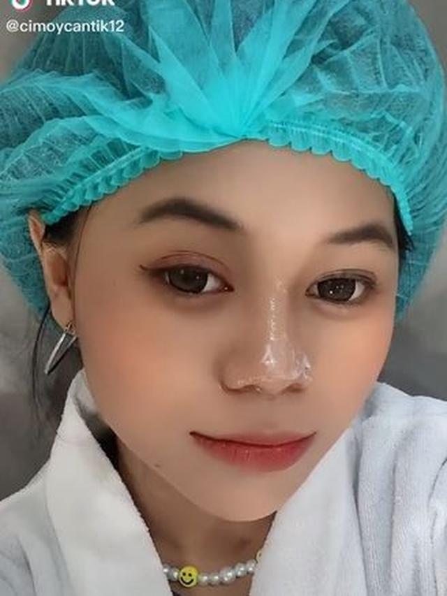 6 Potret Terbaru Cimoy Nuraini Usai Filler Hidung, Tampil Beda