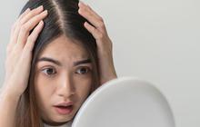 Rambut Lepek dan Berminyak Disebabkan Oleh Kebiasaan Ini, Hentikan Sekarang Juga!