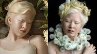 Dibuang ke Panti Asuhan Karena Albino, Ini 6 Potret Xueli Kini Sukses Jadi Model. (Sumber: Instagram/xueli_a)