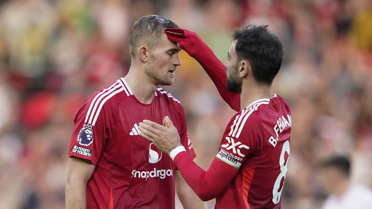 Foto: Pengorbanan Berdarah-Darah Matthijs de Ligt saat Bawa MU Menang Comeback atas Brentford di Liga Inggris