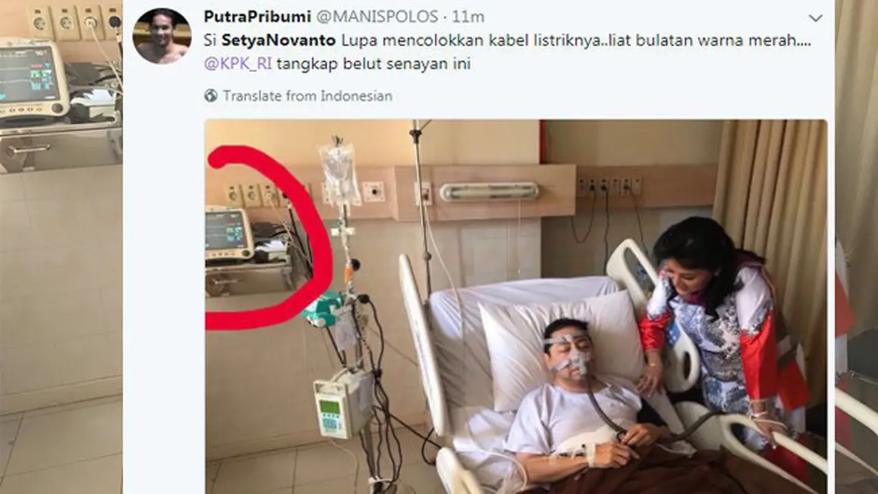 Viral Foto Setya Novanto dengan Alat Bantu Napas