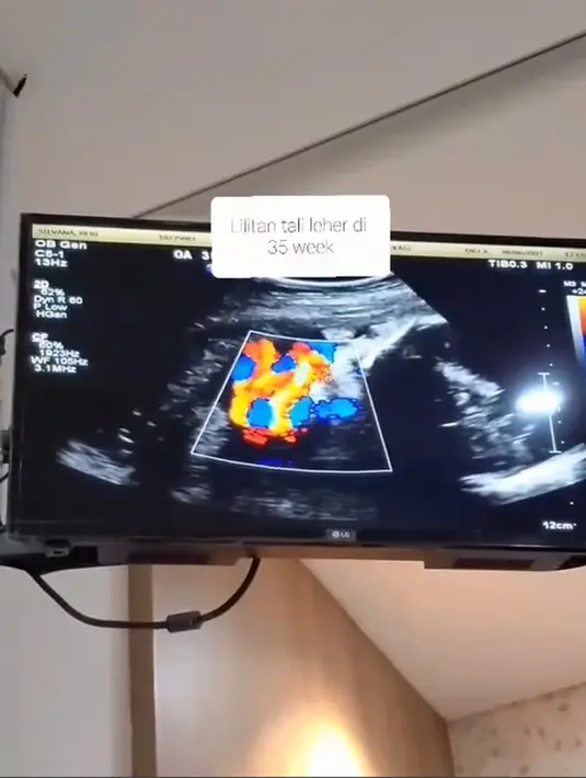 Bebi Silvana (Instagram/bebi.silvana)