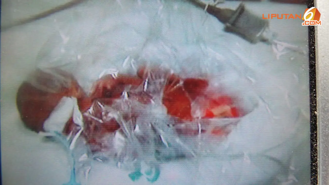 bayi-kembar-lahir-130820b.jpg