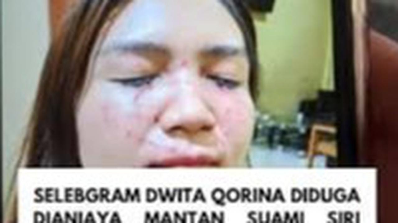 Polisi Tetapkan Mantan Suami Siri Selebgram di Lombok jadi Tersangka Penganiayaan