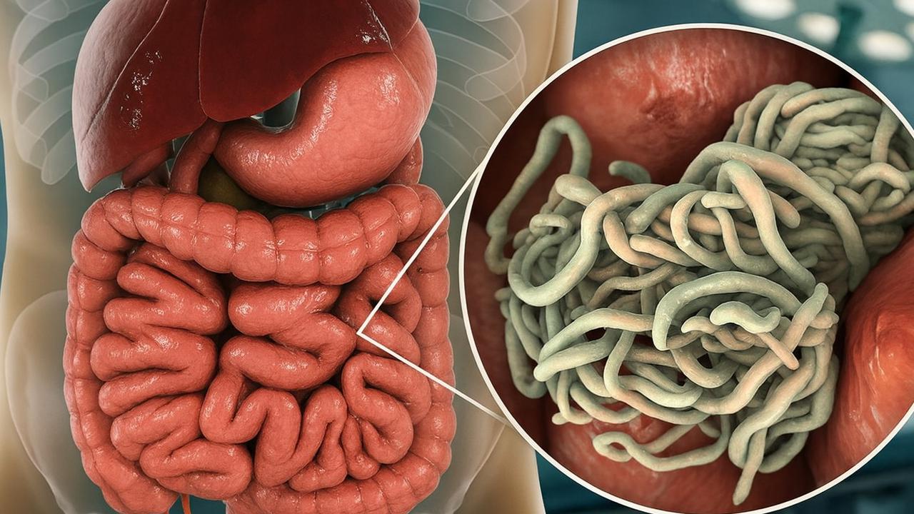 Ini Jenis Cacing yang Umum Menginfeksi Anak-anak, Ketahui Dampaknya Berikut Ini