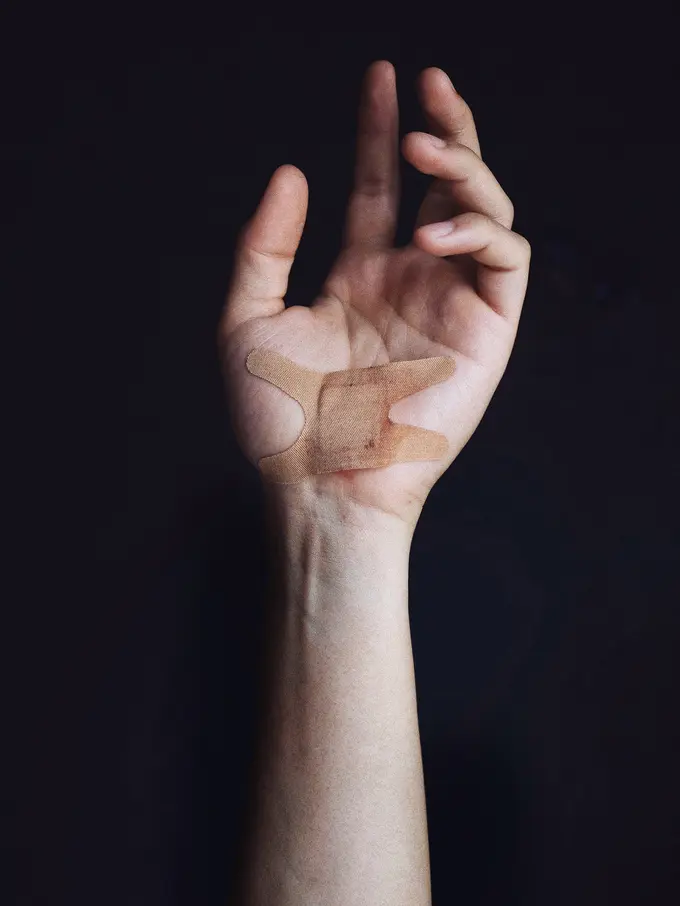 Bekas luka/unsplash Brian