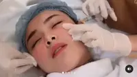 Lakukan Perawatan Wajah, Amanda Manopo Malah Dianggap Nggak Natural