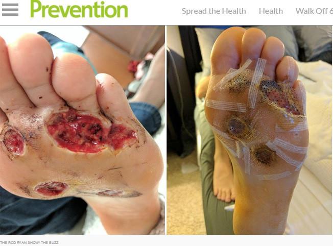 Mandi Telanjang Kaki  di Gym Telapak  Pria Ini Bolong  
