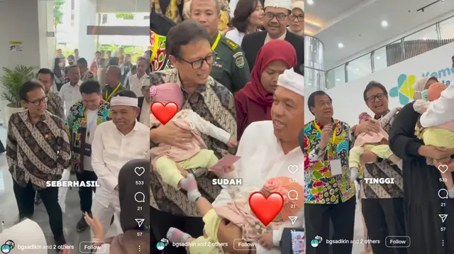 Operasi Bayi Kembar Siam Nadia dan Nadhira Berhasil, Menkes Budi: Nangisnya Kencang. Foto: Instagram @bgsadikin.