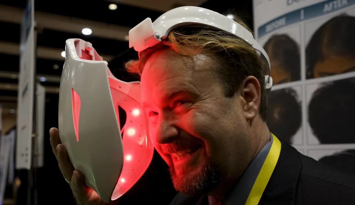 Seorang memakai sebuah alat bernama iDerma yang diperuntukkan bagi orang yang mempunyai gangguan penyakit kulit di muka saat dipamerkan dalam acara Consumer Electronics Show di Las Vegas. (4/1). (REUTERS / Rick Wilking)
