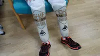 Difabel Cilik Dapat Kaki Baru jelang Boxing Day 