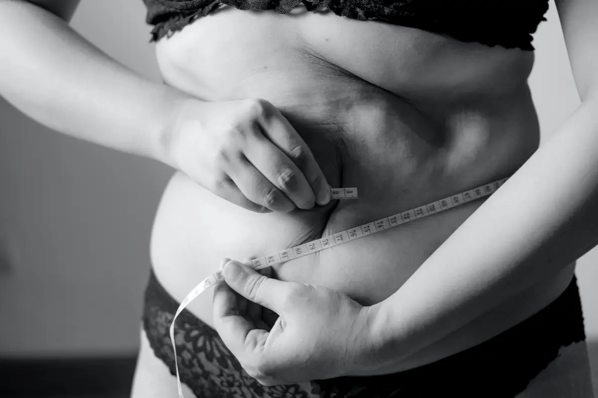 fatphobia