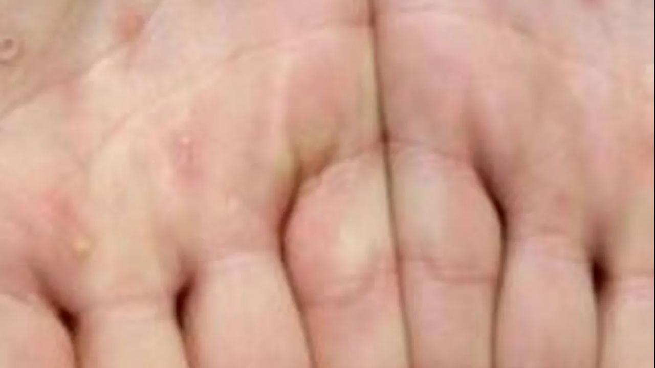 Terdapat delapan orang yang masih berstatus suspek.