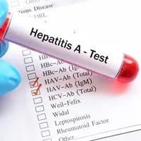 5 Fakta Hepatitis A, Penyakit yang Sedang Mewabah di Pacitan (sumber: iStockphoto)