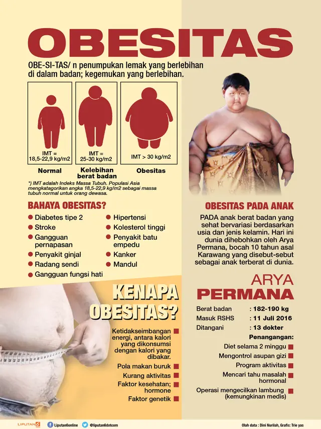 Arya Permana, salah satu contoh kasus obesitas yang mengkhawatirkan (liputan6.com/Tri yasni)