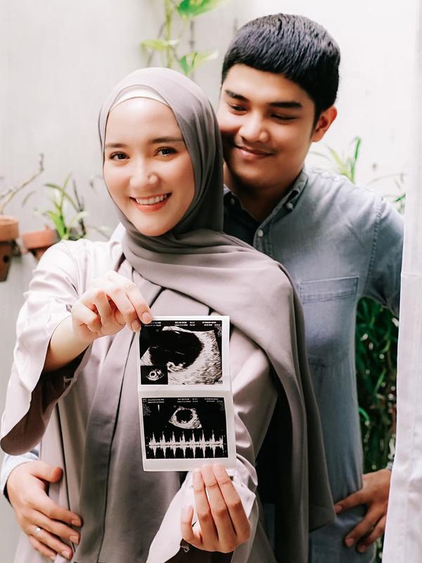 Erica Putri (Sumber: Instagram/ericaputrii)