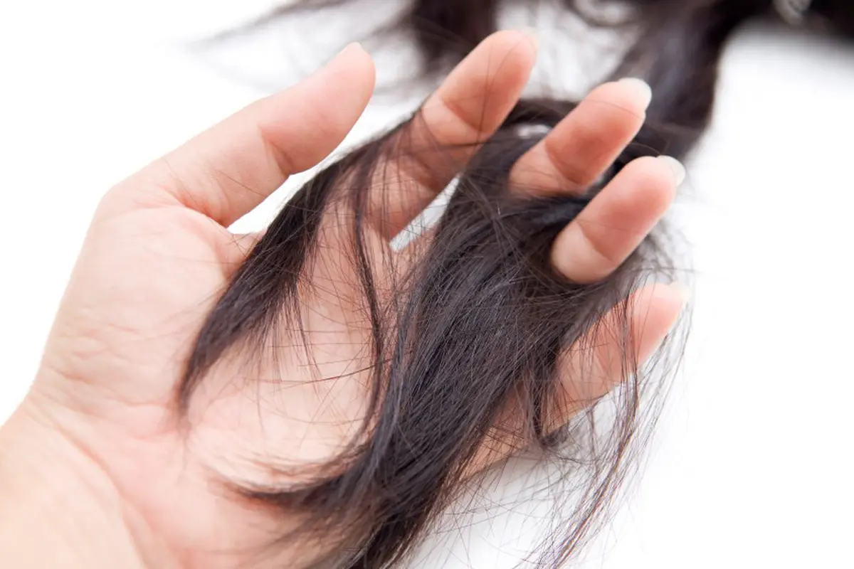 [Bintang] Ketahui 5 Hal Penyebab Utama Rambut Rontok