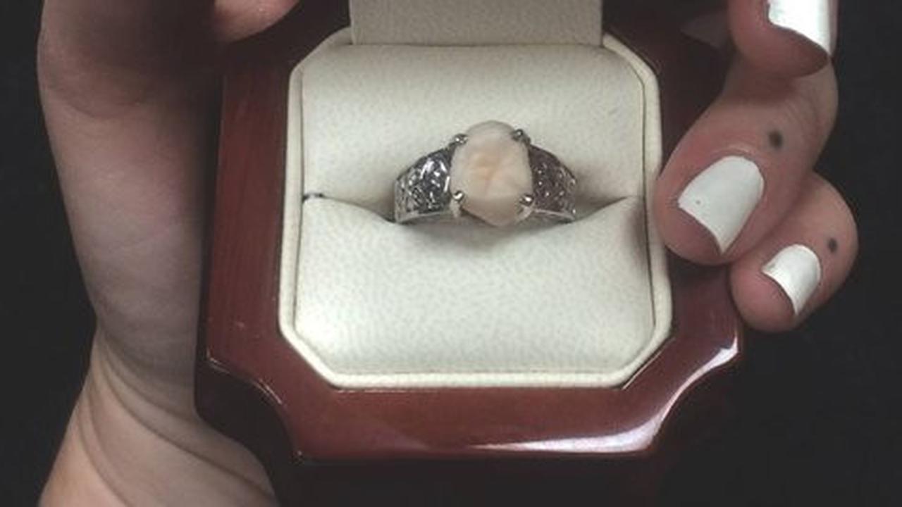 Pria ini melamar kekasihnya dengan cincin bertahta gigi