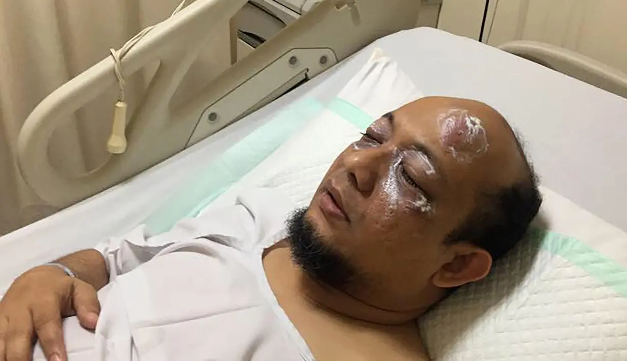 Novel Baswedan saat dirawat di Rumah Sakit Mitra Keluarga Kelapa Gading, Jakarta Utara, Selasa (11/4). Penyidik senior KPK tersebut menjadi korban penyiraman air keras saat pulang Salat Subuh. (AFP Photo/Polri)