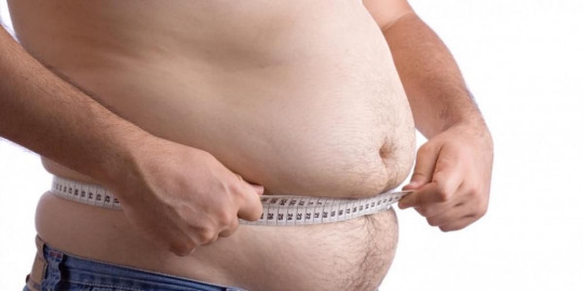 Obesitas