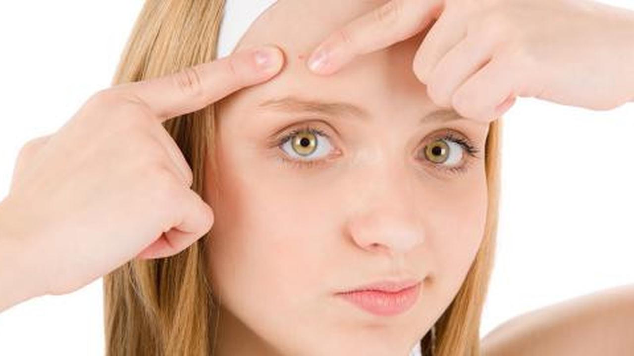 Jerawat pada wanita adalah sinyal kelainan hormon?