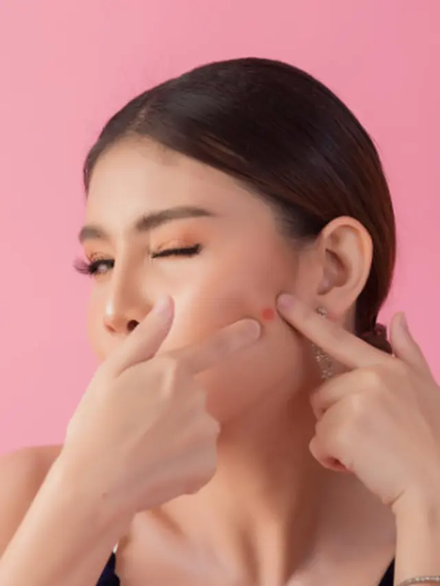 Ilustrasi acne patch (Foto: freepik/jcomp)