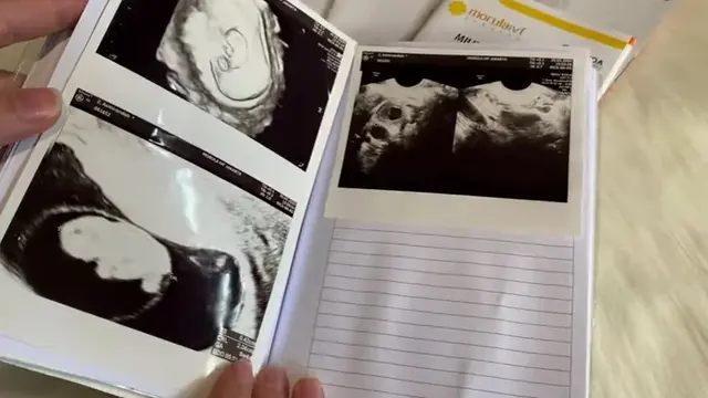 Umumkan Kehamilan, Ini 6 Momen Perjuangan Asmirandah Jalani Program Bayi Tabung