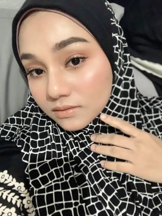 Viral, Wajah Wanita Ini Mendadak Berubah saat Hamil