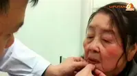 [VIDEO] Usia 28 Tahun, Fisik Wanita di Cina Jadi Nenek 80 Tahun