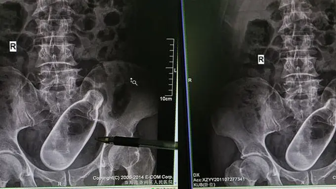 Foto: copyright www.mirror.co.uk