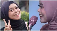 6 Beda Gaya Lesty Kejora Sebelum Vs Sesudah Pakai Behel, Hilangkan Gingsul