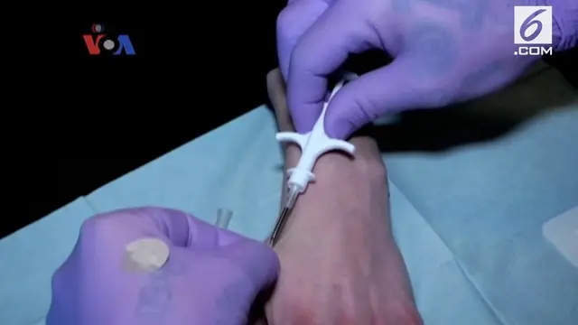 Menanam Microchip di Tangan Pegawai