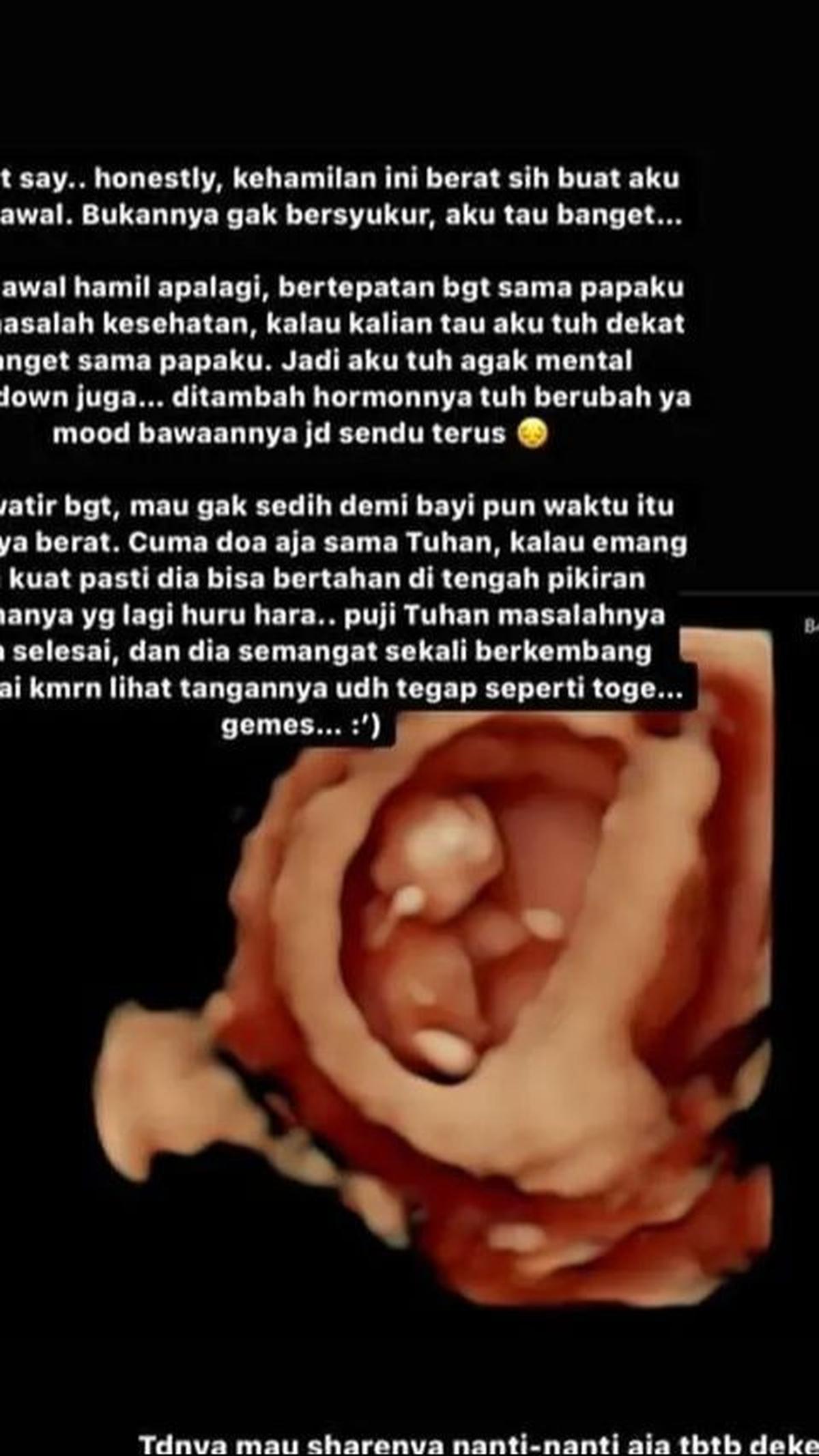 Shanju sedang beradaptasi dengan keadaan barunya yang penuh kebahagiaan dan terharu.<br>
