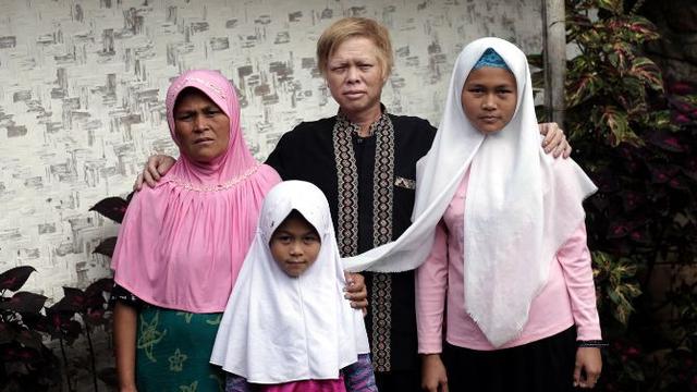 Berkunjung ke Kampung Albino di Tengah Perkebunan Garut
