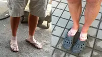 6 Potret Orang Belang di Kaki karena Panas Ini Bikin Senyum