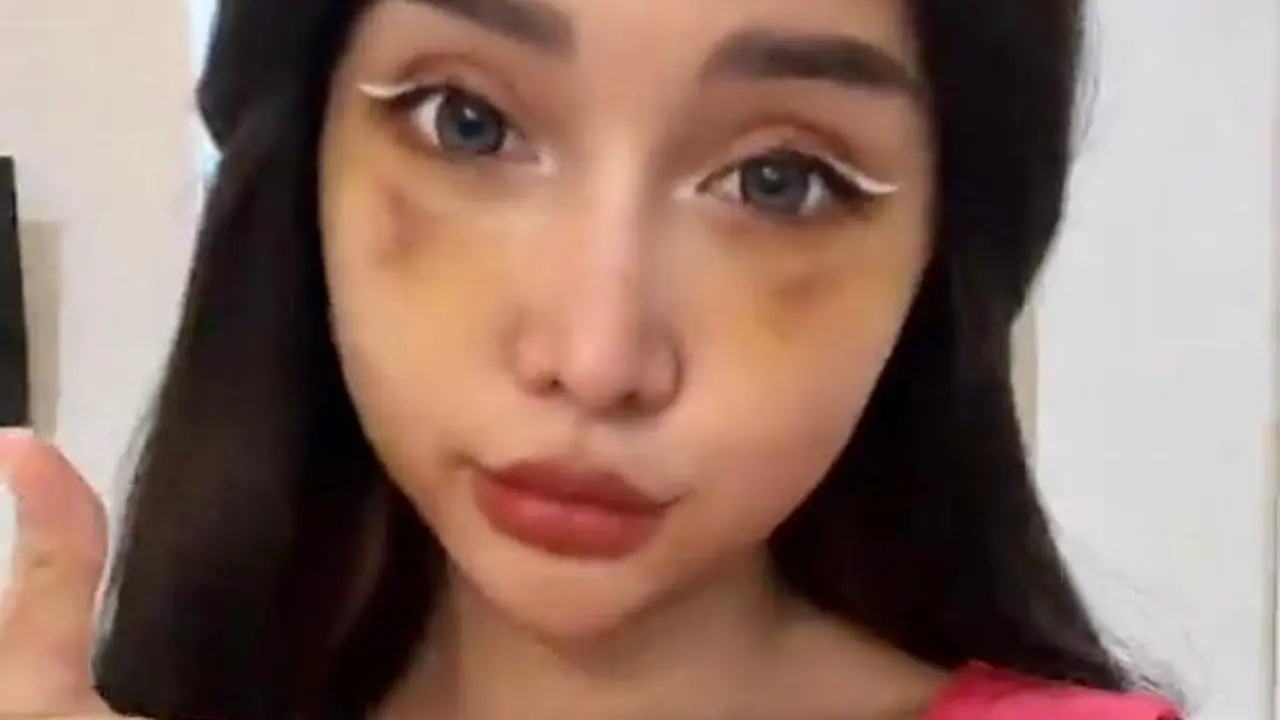 8 Potret Wajah Baru Lucinta Luna usai Operasi Plastik, Disebut Mirip Wonyoung IVE
