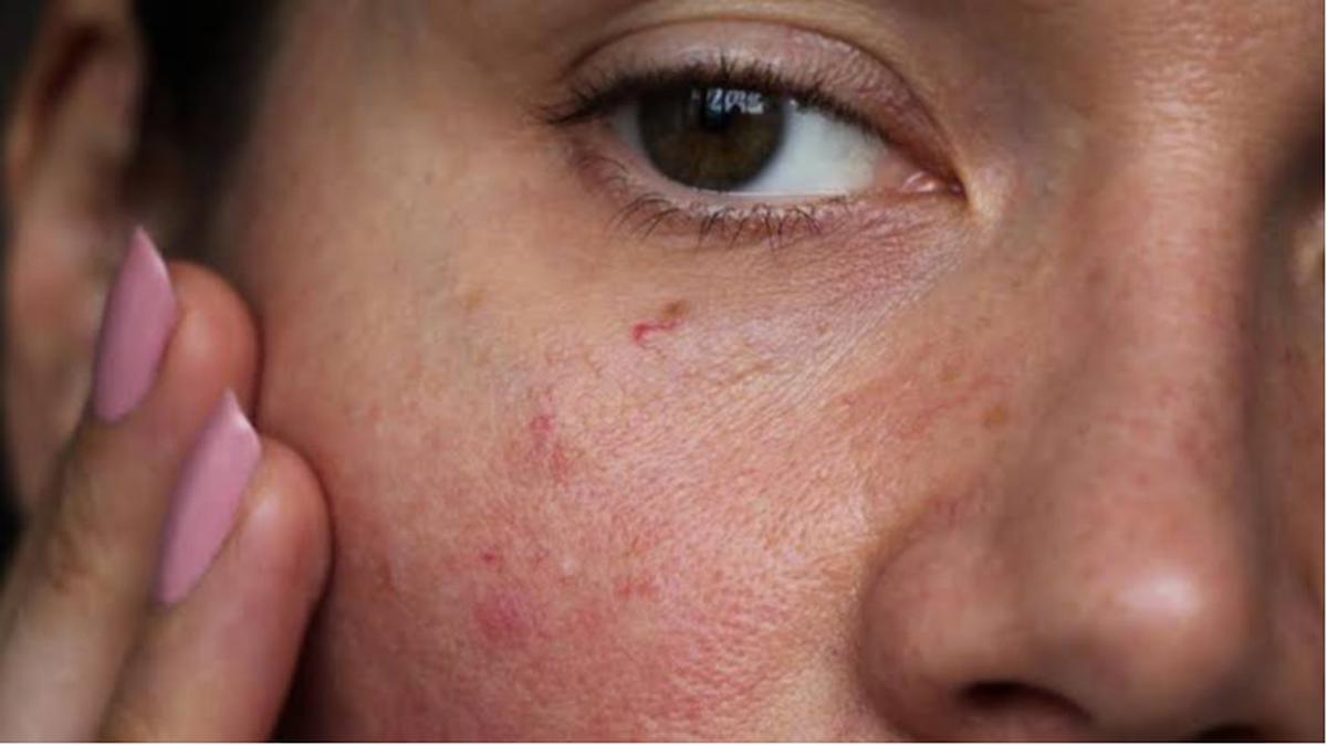 Retinol di Usia 20-an: Rahasia Kulit Mulus atau Overhype?