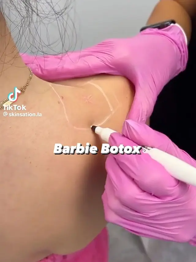 Barbie Botox