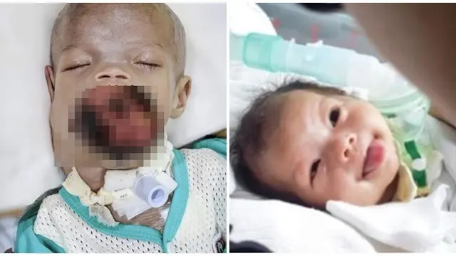 Dicibir Karena Lepas Hijab, Dokter Ini 'Tampar' Netizen dengan Cara yang Menyentuh