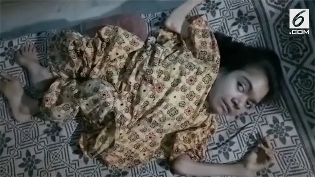 VIDEO: Menderita Kelainan, Tulang Gadis Ini Terus Menyusut