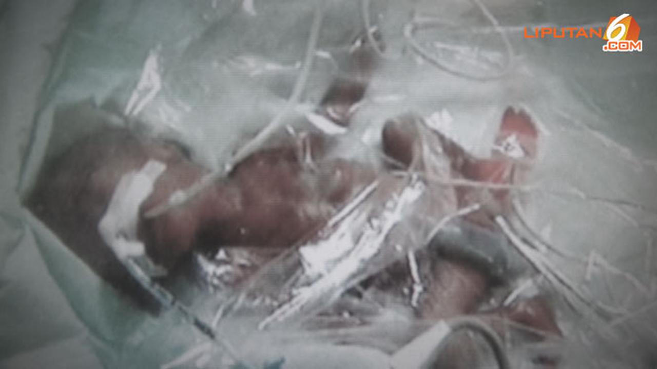 bayi-kembar-meninggal-130821b.jpg