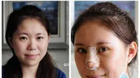 Muak dengan Makeup, Wanita Ini Pilih Operasi Plastik