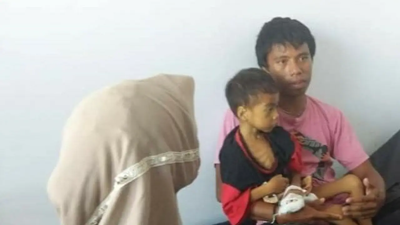 La Rungge (6), bocah penderita gizi buruk di Buton Tengah, saat dirawat.(Liputan6.com/Ahmad Akbar Fua)